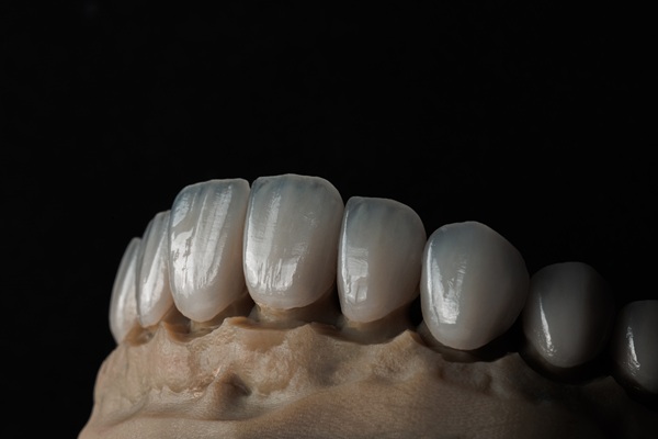 How To Extend The Life Of Your Implant Crown